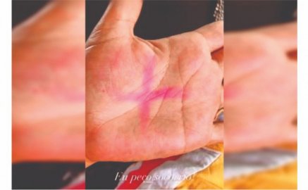 A vítima postou nas redes sociais a foto com X na palma da mão -