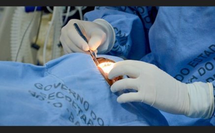 Transplante de córneas Tocantins