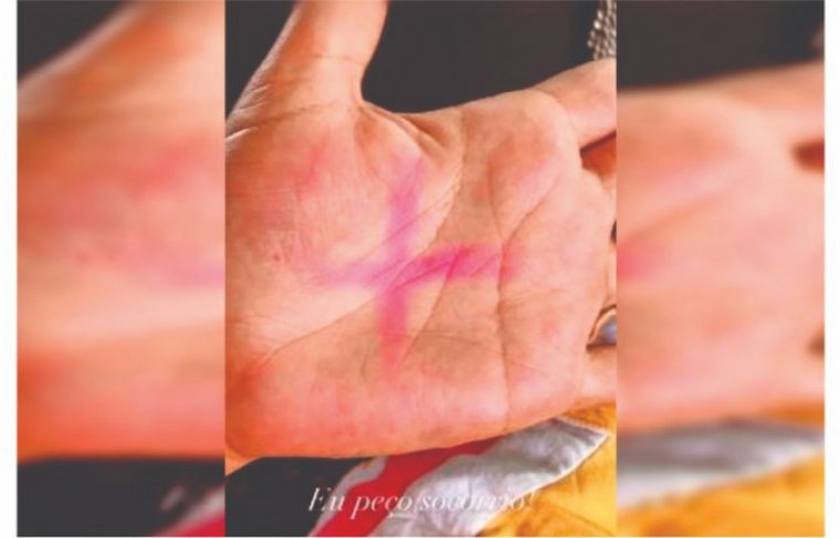 A vítima postou nas redes sociais a foto com X na palma da mão - Crédito: Reprodução Instagram